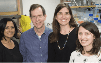 Children with Alagille Syndrome have malformed bile ducts